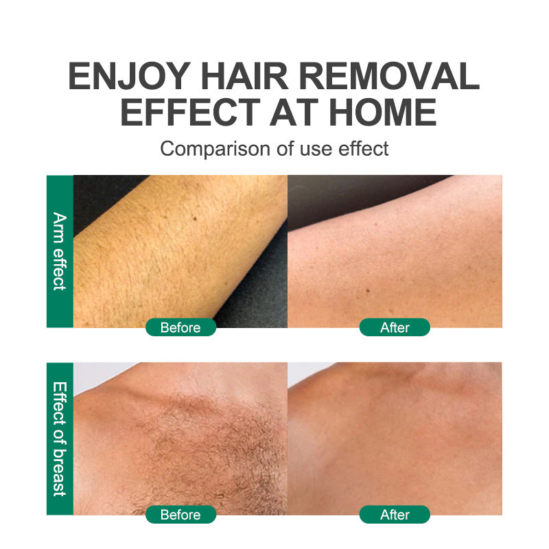 Crystal Hair Remover